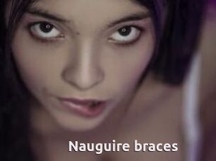 Nauguire_braces